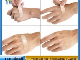 TPU透明医用薄膜 一次性tpu医疗膜 源头厂家  赞晨